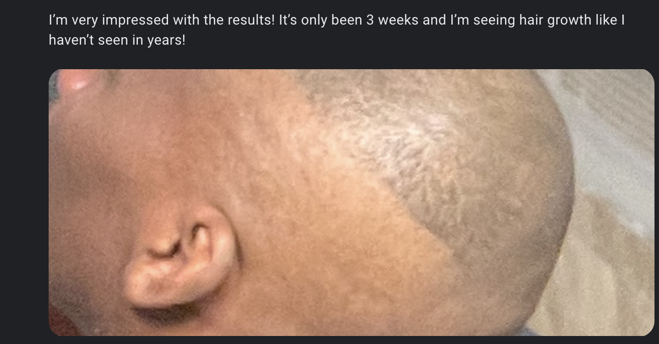 Before and After Results